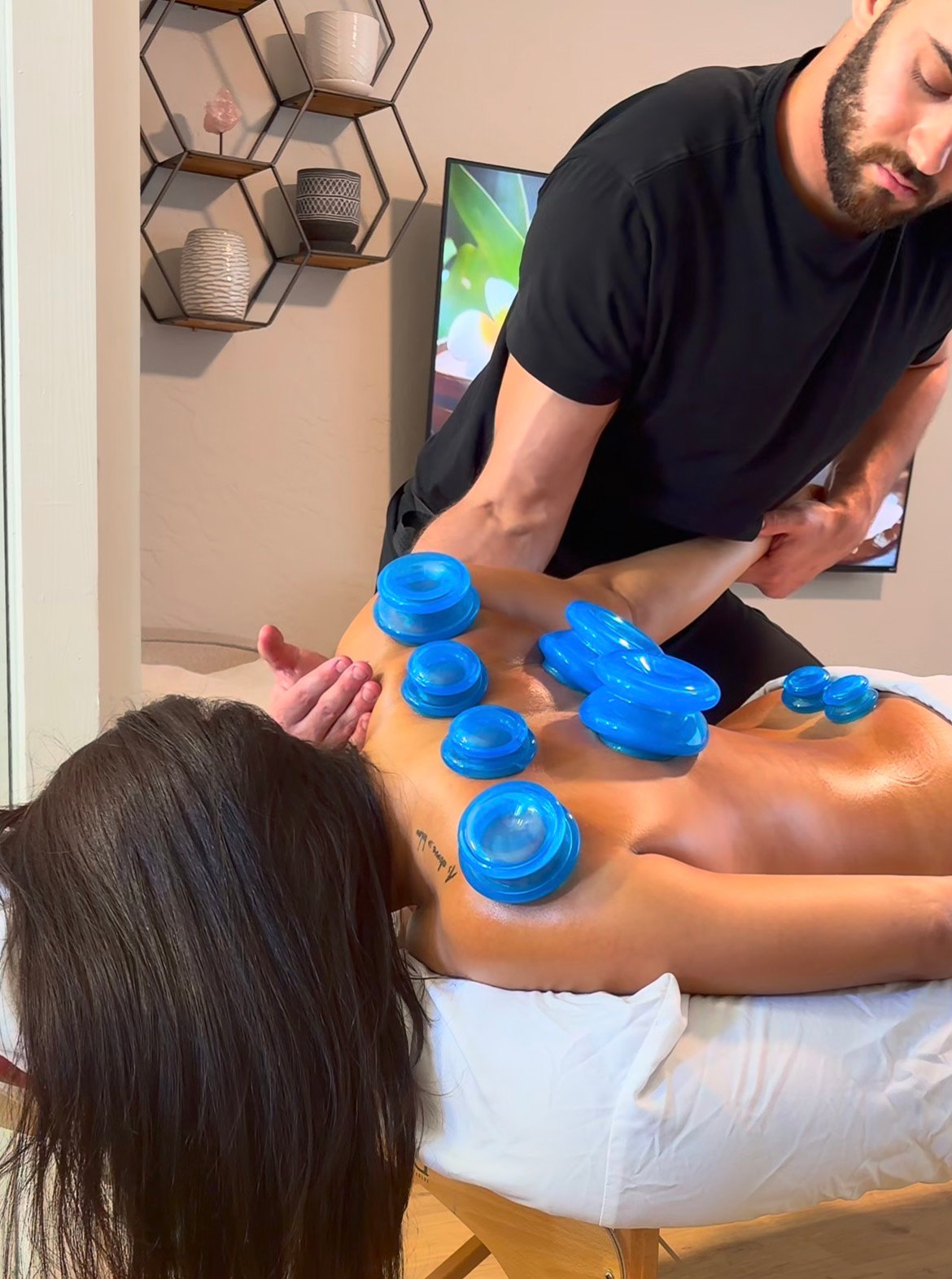 Cupping — decompression instead of compression